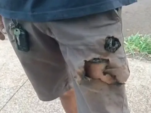 Điện thoại bất ngờ phát nổ giúp người đàn ông thoát khỏi chó dữ