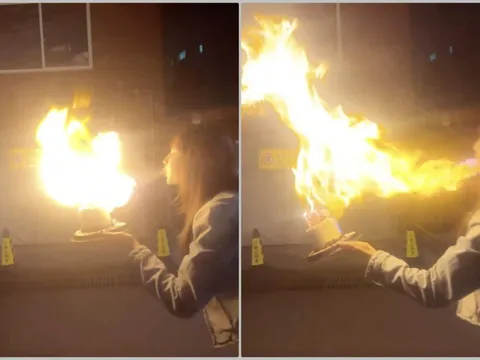 Nữ diễn viên phải nhập viện cấp cứu vì chiếc "bánh sinh nhật phun lửa"