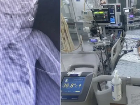 Bé gái hơn 1 tuổi bị ngưng tim, ngưng thở chỉ vì phút lơ là của người lớn: Bác sĩ cảnh báo nguy cơ tiềm ẩn từ những vật dụng quen thuộc này trong nhà