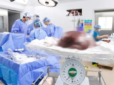 Phát hiện "vật thể lạ" nặng gần 12kg, to như bụng mang song thai trong người cô gái trẻ