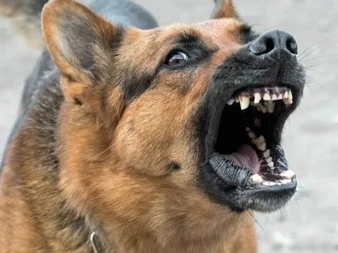 Chỉ sau một tháng từ khi bị chó cắn vào mặt, bé trai 11 tuổi bất ngờ trở nặng rồi qua đời khiến nhiều người xót xa