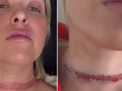 Thời trang suýt thành thảm kịch, nữ fashionista suýt bị “chém đầu” vì một phụ kiện quen thuộc