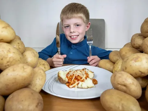 Suốt 7 năm chỉ ăn khoai tây, cậu bé này gặp phải tình trạng lạ khiến bố mẹ phải cầu cứu ... thầy thôi miên