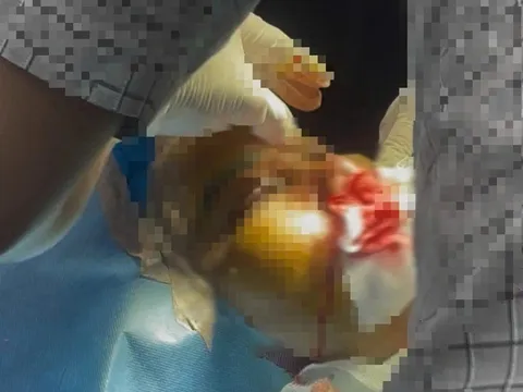 Hé lộ danh tính người phụ nữ tử vong sau khi được "truyền trắng da" tại nhà, ai là người truyền?