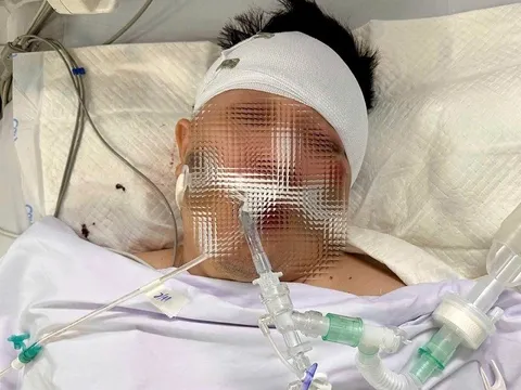 Nam thanh niên nguy kịch sau khi tông trúng chó chạy rông sang đường