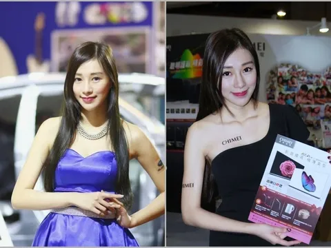 Nữ người mẫu tử vong sau khi tiêm propofol chữa mất ngủ