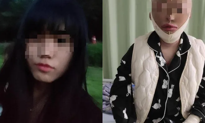 12 năm tù cho thanh niên tạt xăng hủy hoại cuộc đời bạn gái vì đòi chia tay
