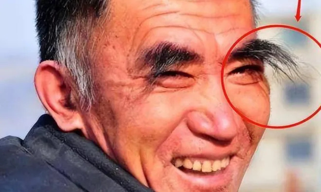Cổ nhân nói: "30 lông dài thì 40 đột tử, 50 lông mọc là mệnh trường thọ", vì sao thế?