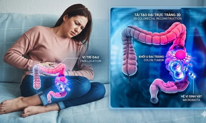 Ung thư đại trực tràng ở phụ nữ: Những triệu chứng âm thầm đừng nên ngó lơ