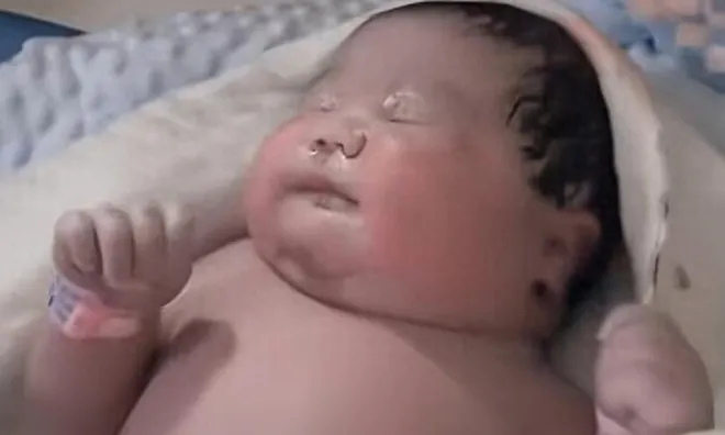 Bé sơ sinh chào đời da vừa đỏ vừa tím, nặng 7kg, y tá bế khỏi phòng mổ cả gia đình hoang mang