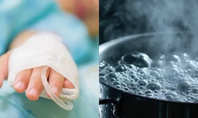 Đau lòng bé trai 2 tuổi bị nhân tình của mẹ dội nước sôi vào người tử vong