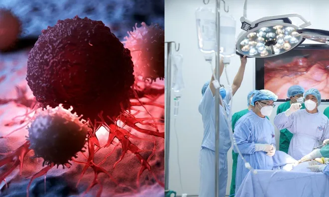 6 thói quen thường gặp khiến người trẻ dễ mắc ung thư cần biết để tránh ngay