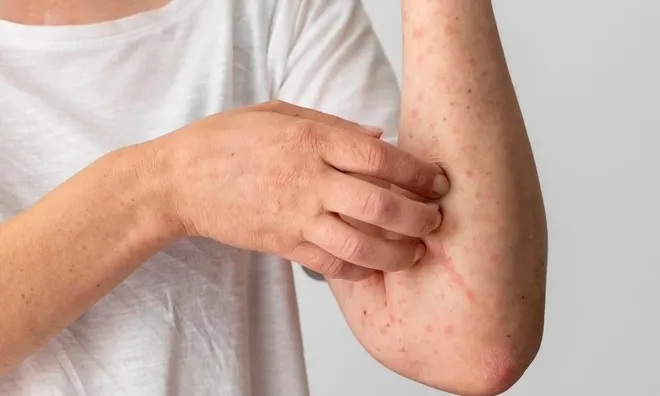 Người phụ nữ ngứa chân suốt 2 tháng, đi khám phát hiện mắc ung thư: Cảnh báo 4 dấu hiệu bất thường trên da cần lưu ý