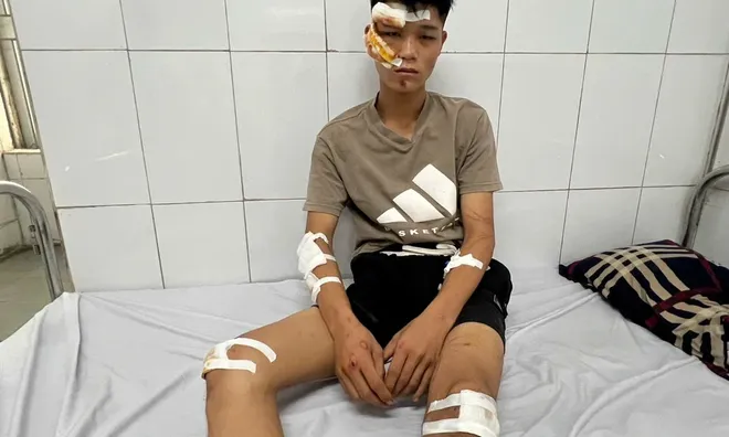 Lời khai gây phẫn nộ của "quái xế" đâm cảnh sát cơ động chấn thương sọ não: Lỗi chồng lỗi sẽ chịu hình phạt thế nào?