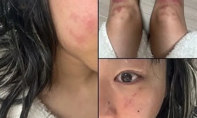 Nữ ca sĩ tố bị bạn trai giam giữ, bạo hành: Những chia sẻ đau nhói trong suốt 2 tuần "sống trong địa ngục"