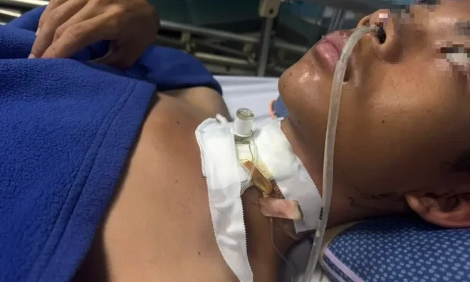Dây điện sà xuống đường như lưỡi dao, cứa đứt khí quản thiếu niên 15 tuổi, may mắn nạn nhân được cứu sống thần kỳ
