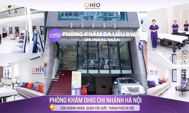Địa chỉ trị giãn mao mạch tốt nhất tại Hà Nội