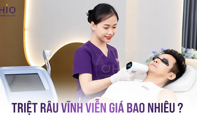 Triệt râu vĩnh viễn giá bao nhiêu?