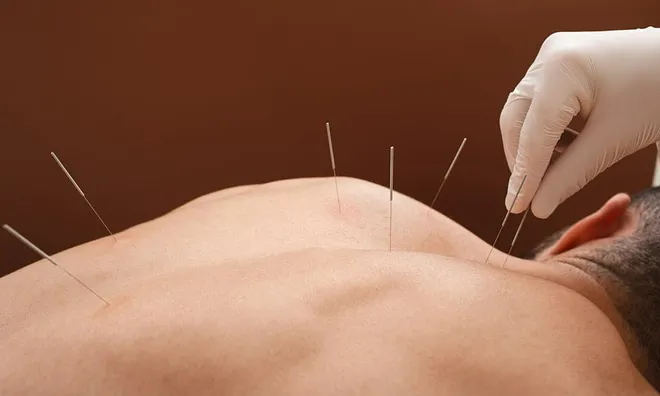 Tin lời "lang băm", người đàn ông suýt mất mạng sau buổi châm cứu trong... quán net