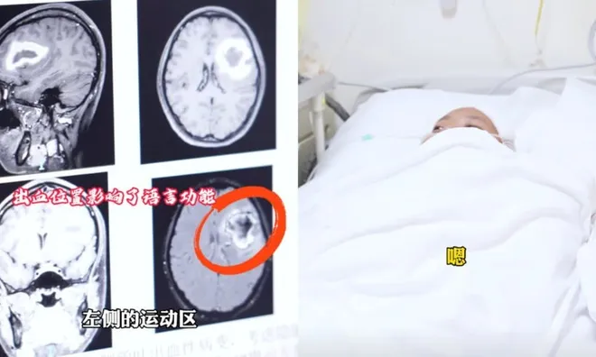 Cô gái trẻ bỗng dưng "mất gốc" tiếng Anh, bác sĩ đau đầu đi tìm lời giải