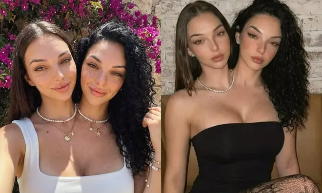 Hé lộ sự thật về cô gái 2 đầu gây sốt MXH