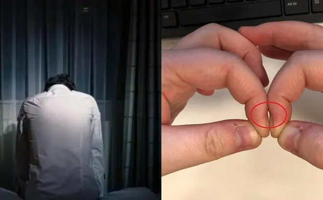 Tại sao ung thư phổi khi phát hiện thường đã ở giai đoạn cuối?