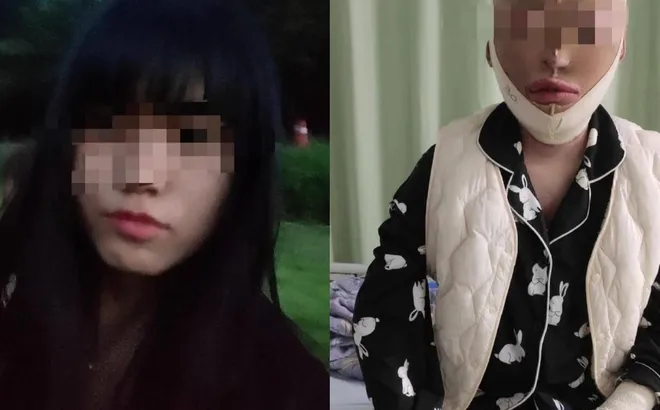 12 năm tù cho thanh niên tạt xăng hủy hoại cuộc đời bạn gái vì đòi chia tay