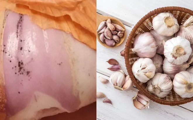 Tại sao nên "đoạn tuyệt" hành, tỏi khi có đốm đen dù không bị hỏng?