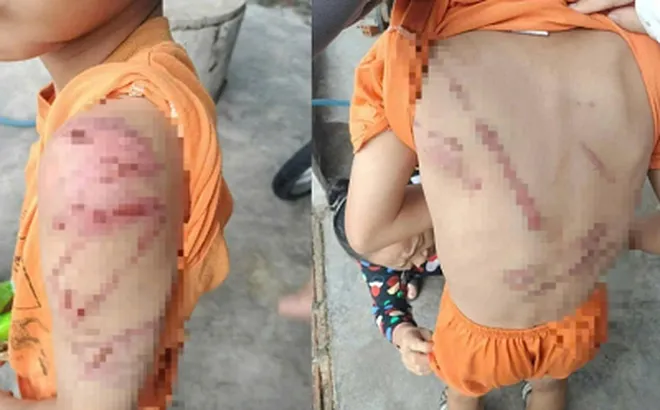 Bố “dạy con” bằng bạo lực, cơ quan công an vào cuộc