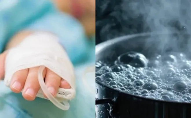 Đau lòng bé trai 2 tuổi bị nhân tình của mẹ dội nước sôi vào người tử vong