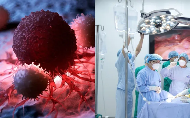 6 thói quen thường gặp khiến người trẻ dễ mắc ung thư cần biết để tránh ngay