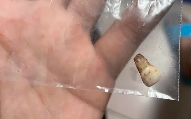 Bé 9 tháng bị đè nghẹt dưới chăn đến tử vong, bảo mẫu vô cảm bỏ mặc suốt 3 giờ