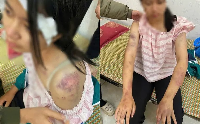 Khởi tố bà nội và 2 ông bạo hành bé gái 13 tuổi ở Thái Nguyên