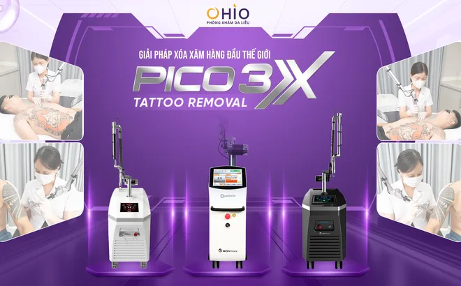 Hình ảnh sau khi xóa xăm bằng Laser tại phòng khám da liễu uy tín