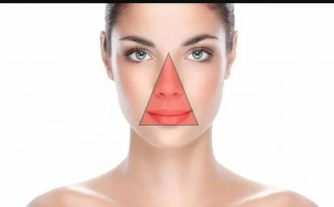 Nặn mụn ở "tam giác tử thần" trên mặt, người phụ nữ nhập viện khẩn cấp, bác sĩ cảnh báo nguy cơ tử vong