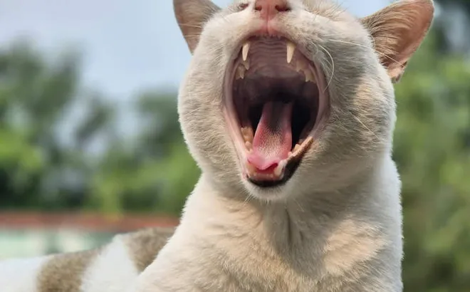 Người phụ nữ ngáp gãy cả cổ