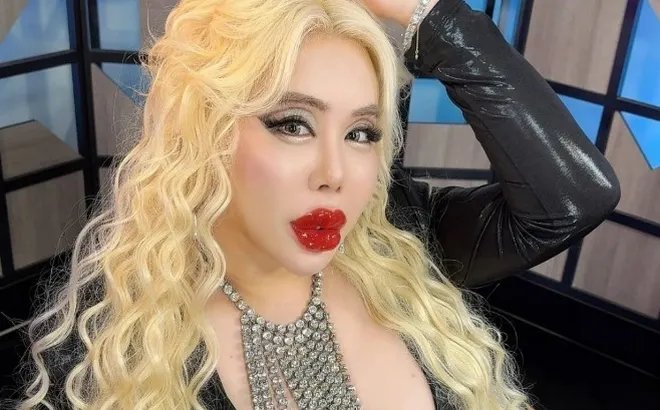 Bị bắt nạt từ nhỏ, chàng trai chi hơn 17 tỷ đồng để biến thành "người đẹp nhất thế giới”